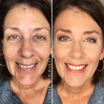 Ageless Skin Kit (+2 Free Gifts)